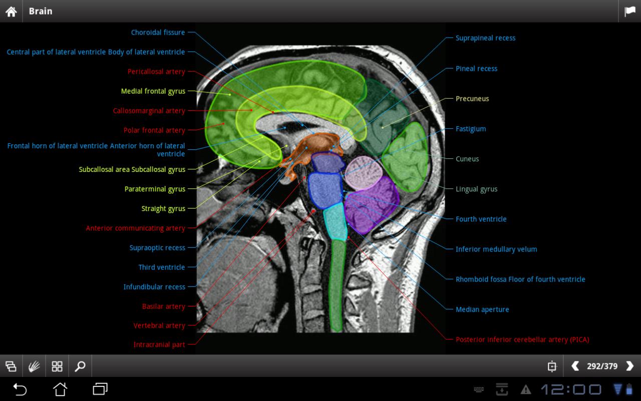 IMAIOS e-Anatomy Mod Apk Full Cracked Download Free | crackedapkfull.com